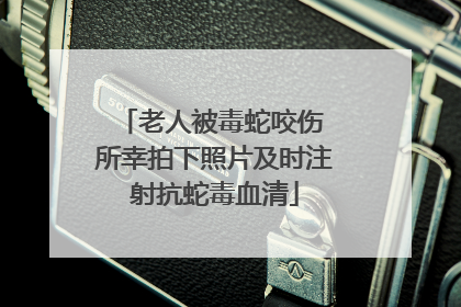 老人被毒蛇咬伤 所幸拍下照片及时注射抗蛇毒血清